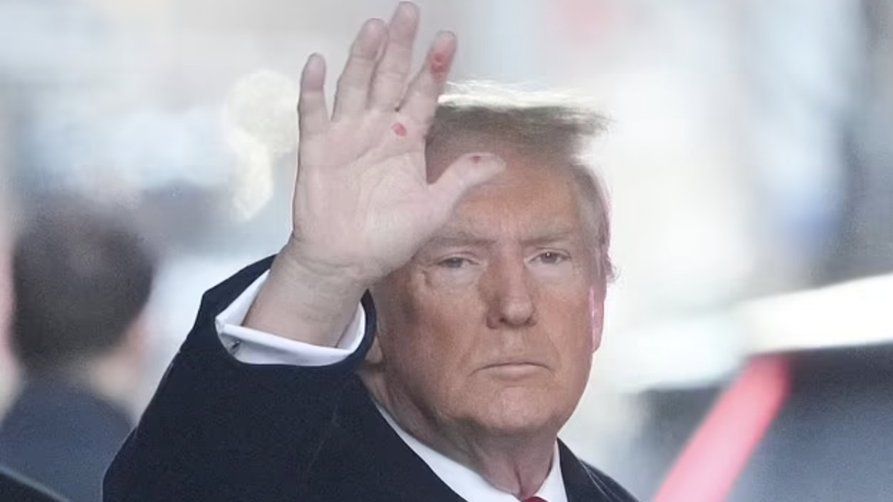 Tajemné červené skvrny na Trumpově dlani